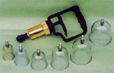 λ Cupping Set